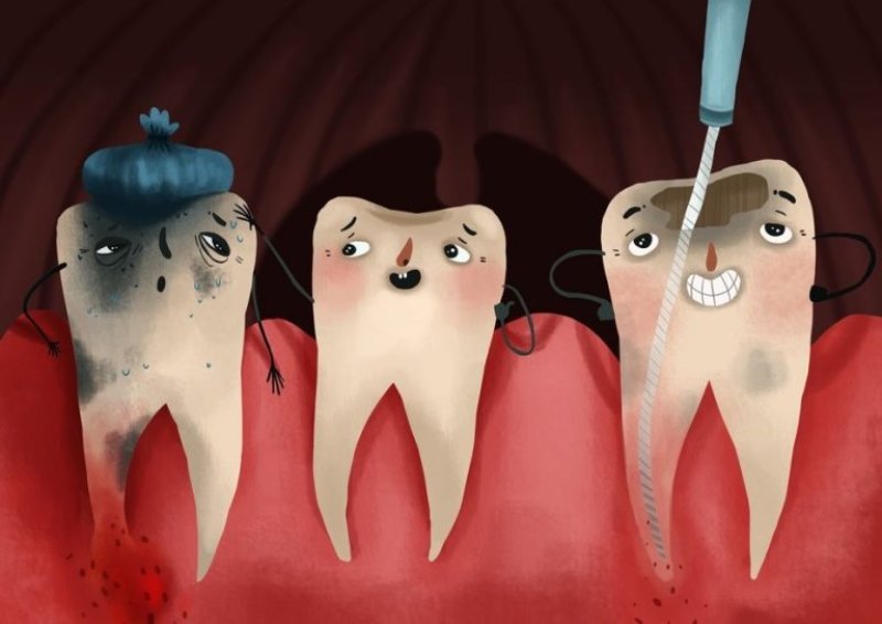 عصب‌کشی دندان