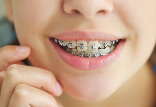 ارتودنسی دندان راهی به سوی لبخندی زیبا