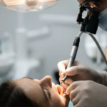 اشتباهات رایج دندانپزشکان در استفاده از فایل‌های روتاری و نحوه جلوگیری از شکست ابزار