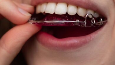 مراقبت های بعد از برداشتن ارتودنسی