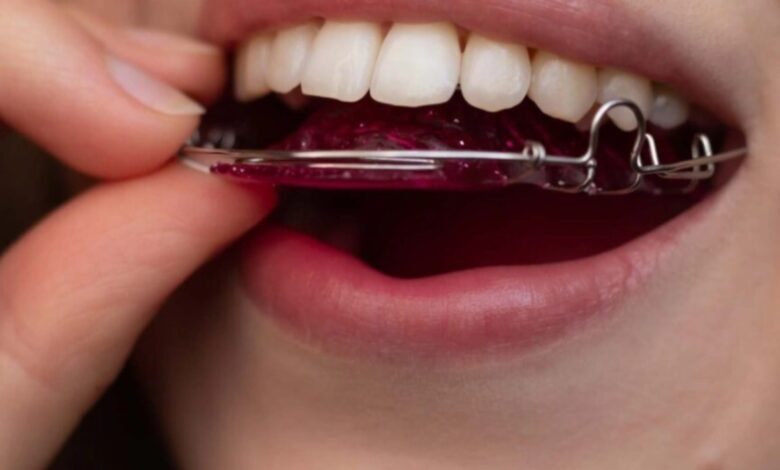 مراقبت های بعد از برداشتن ارتودنسی