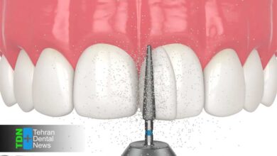 عوارض کامپوزیت ارزان چیست؟ چرا نباید همه چیز را فدای هزینه کمتر کرد و چه راه حلی داریم در 1404