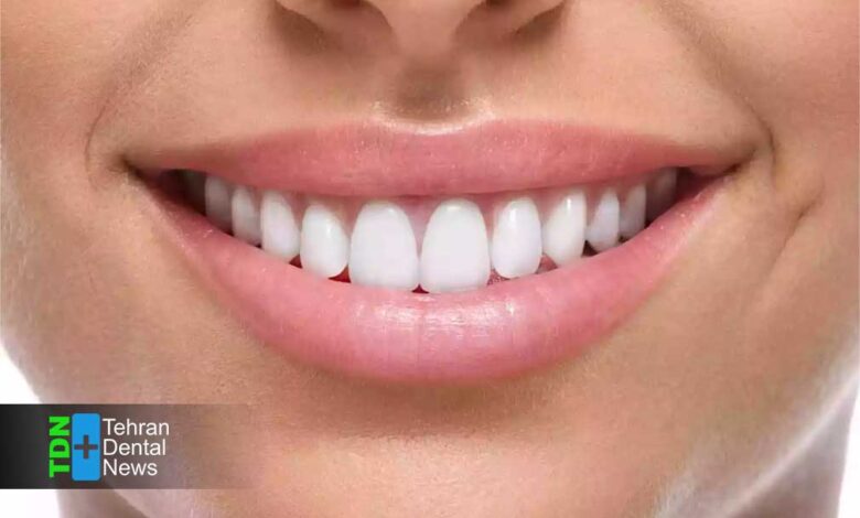 هزینه واقعی کامپوزیت دندان در تهران چقدر است؟ مقایسه قیمت بر اساس نوع مواد و برند در 1404