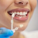 اشتباهات رایج مراقبت از لمینت دندان که باعث آسیب و کاهش عمر آن می شوند و راهکارهای جلوگیری از آنها