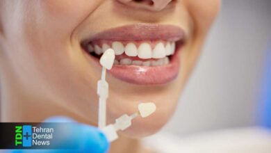 اشتباهات رایج مراقبت از لمینت دندان که باعث آسیب و کاهش عمر آن می شوند و راهکارهای جلوگیری از آنها